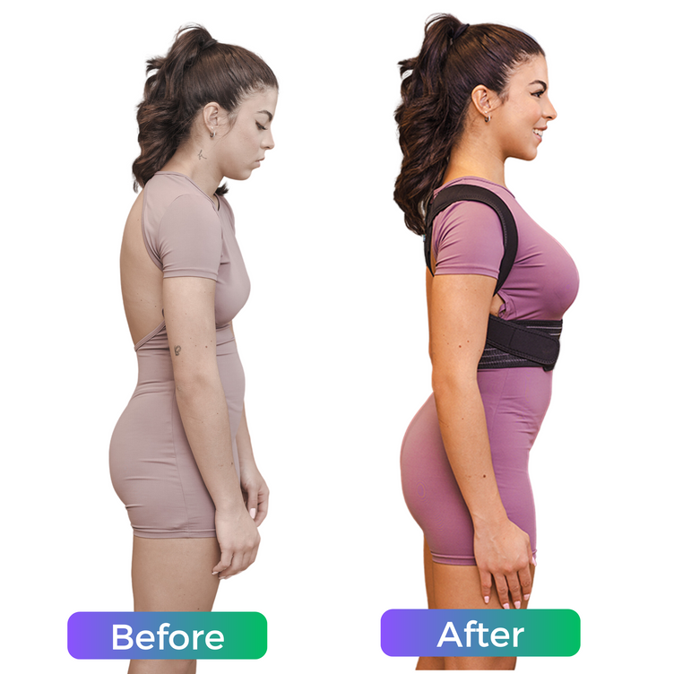 Relieve Back Pain & Improve Posture with Cayatch Orthopedic Back Brace Posture Corrector